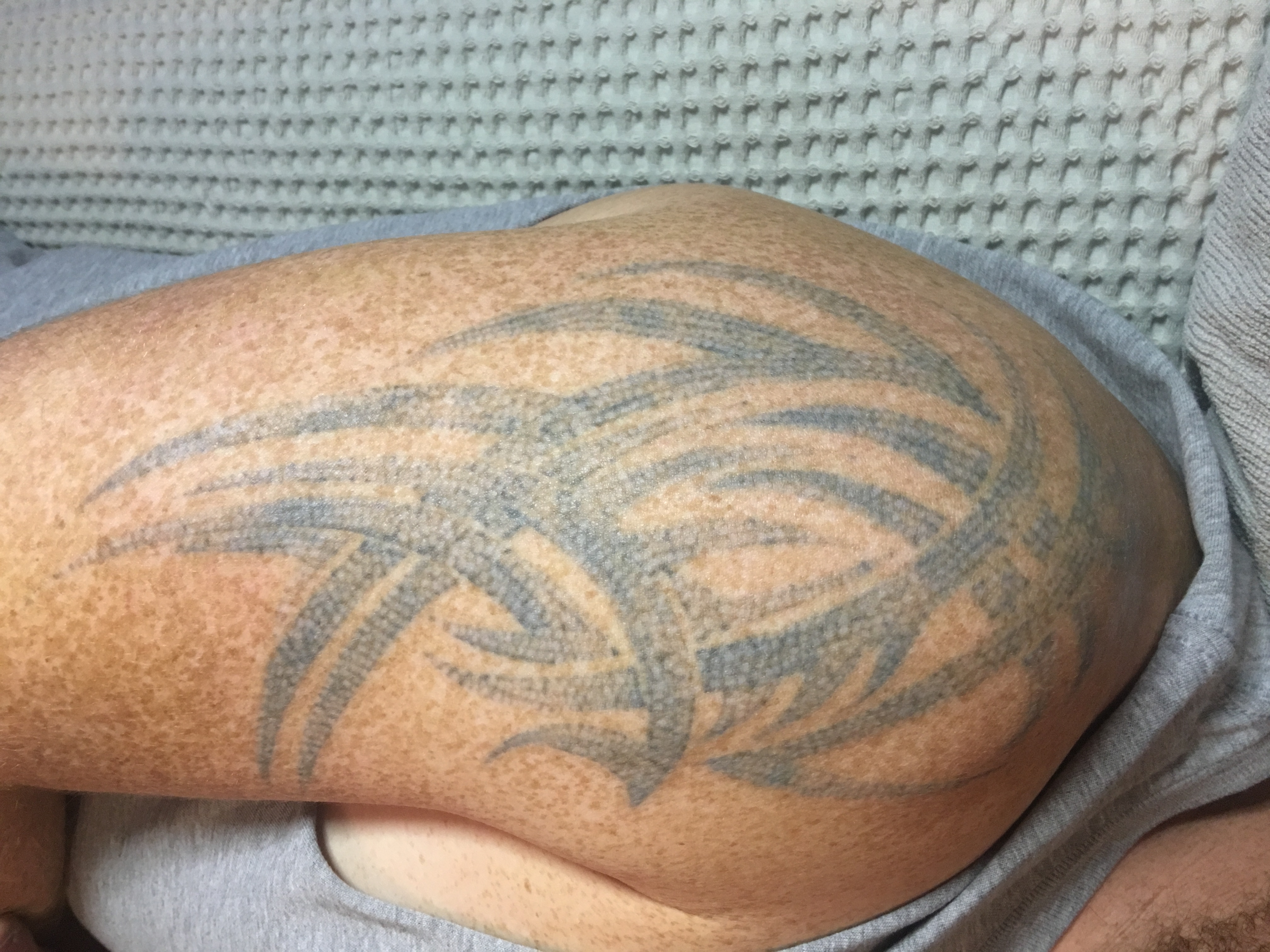 Tattoo Cost Geelong | geelong tattoo removal revive hair skin body geelong Tattoo Cost Geelong | geelong tattoo removal revive hair skin body geelong