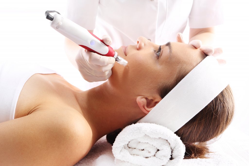 skin needling geelong